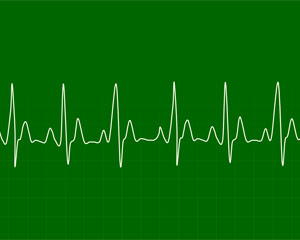 cardiac rhythm
